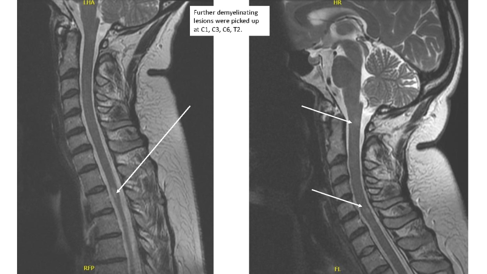 Radiology case #3_image10