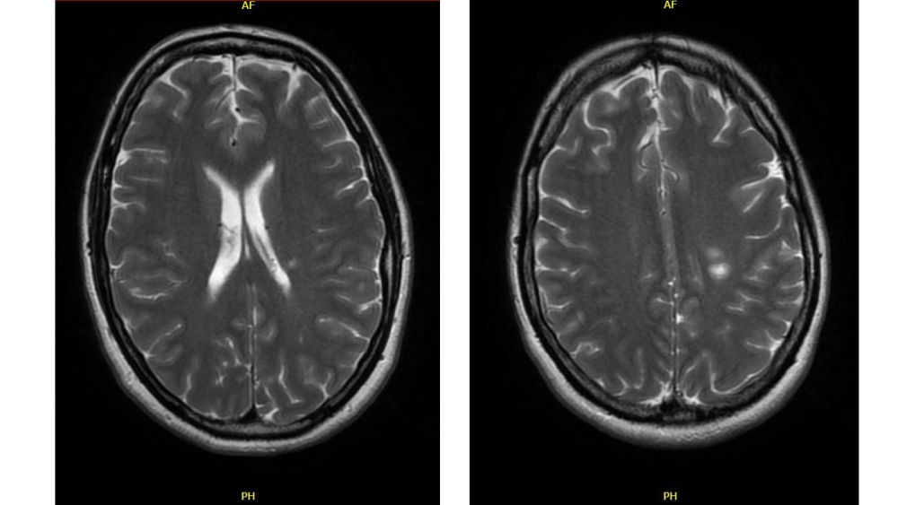 Radiology case #3_image11