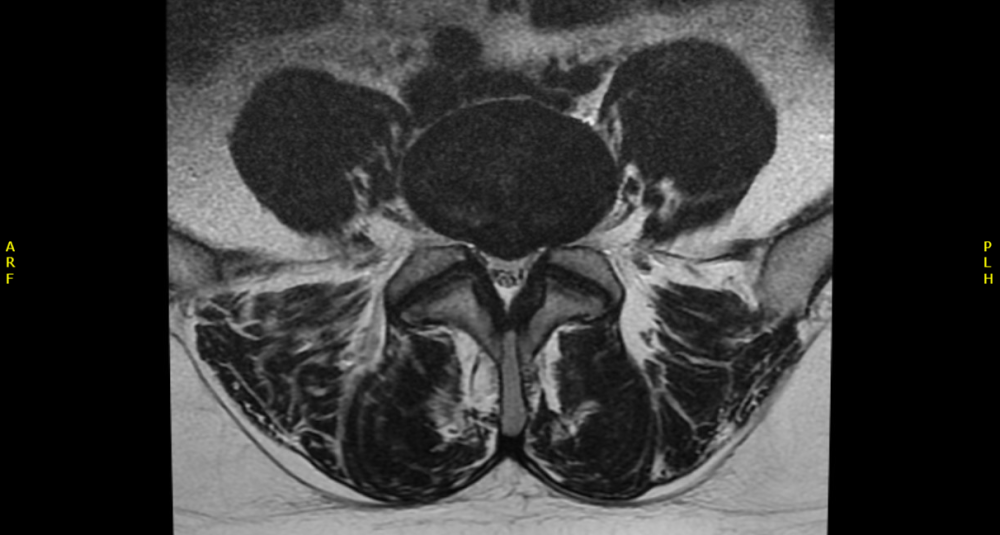 Radiology case #3_image2