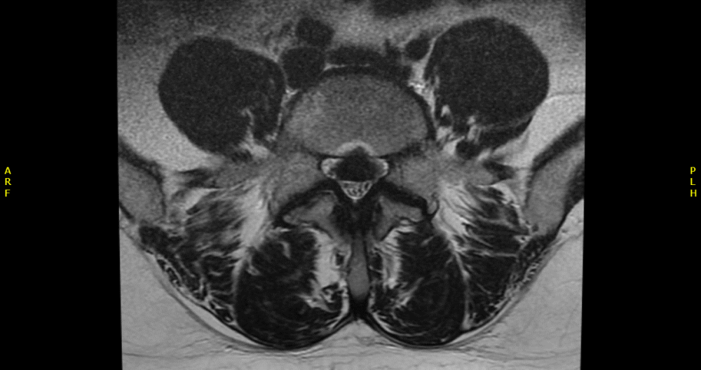 Radiology case #3_image5