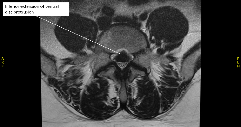 Radiology Corner: Case #3_image 6