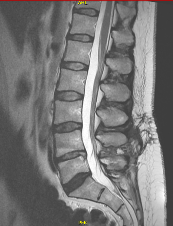 Radiology Corner: Case #3_image 7