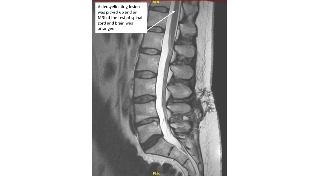 Radiology case #3_image8