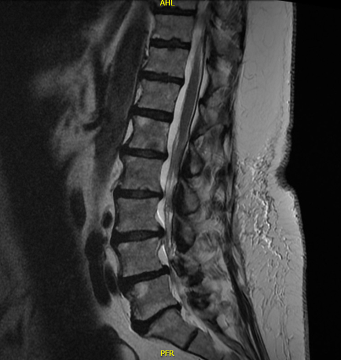 Radiology case #5_1