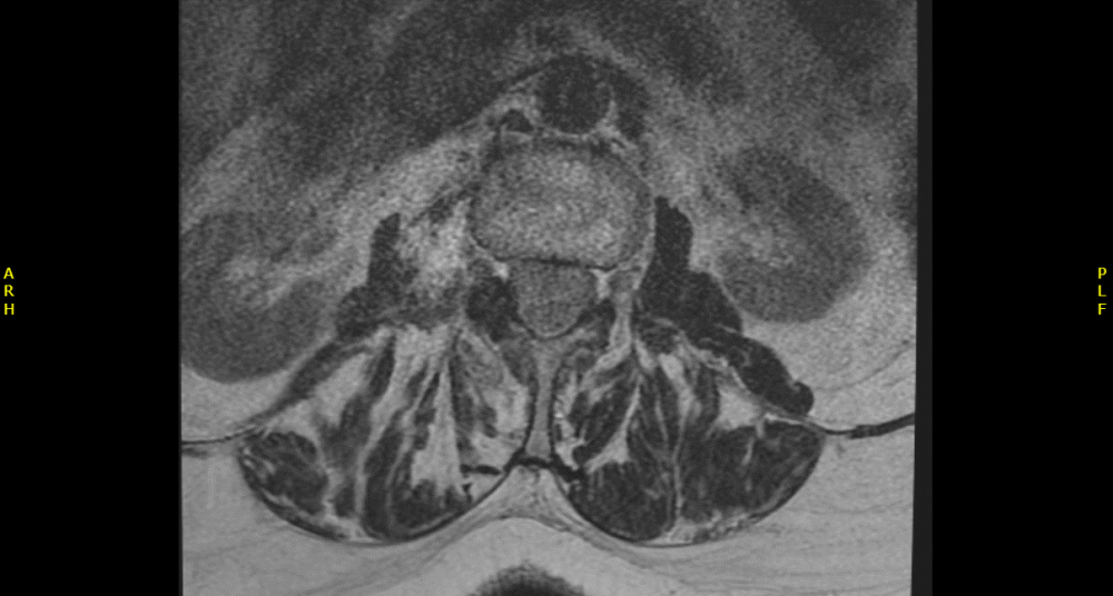 Radiology case #6_2