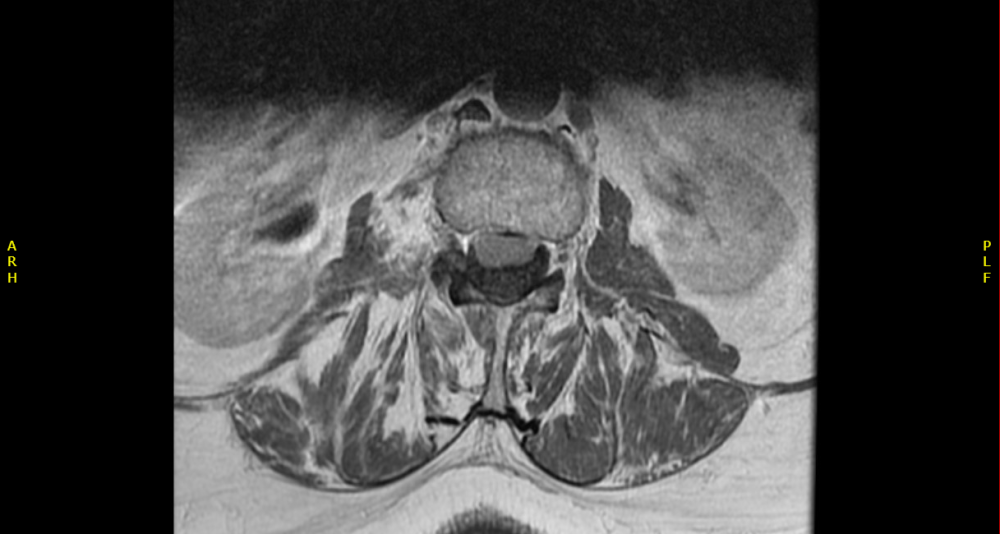 Radiology case #6_3