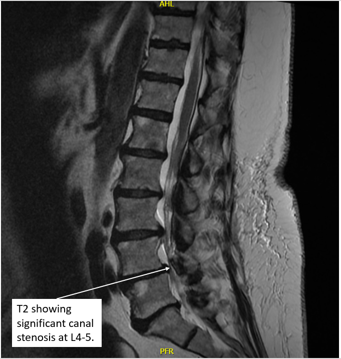 Radiology case #5_3