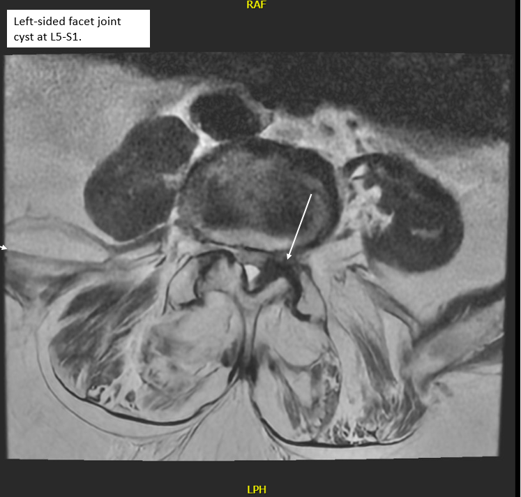 Radiology case #4_4