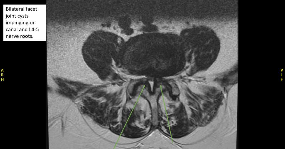 Radiology case #5_4