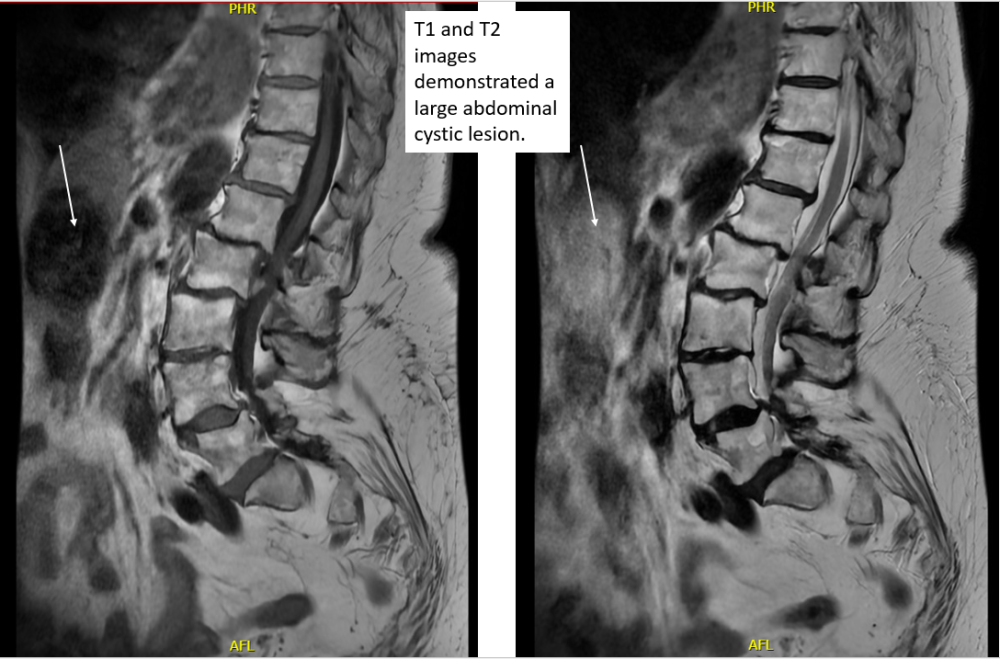 Radiology case #4_6