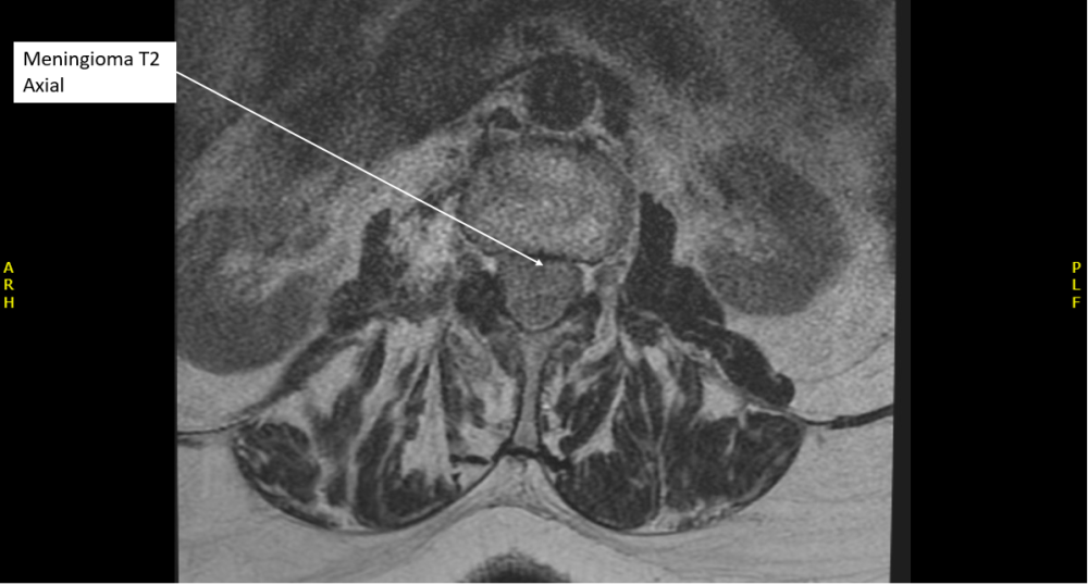 Radiology case #6_6