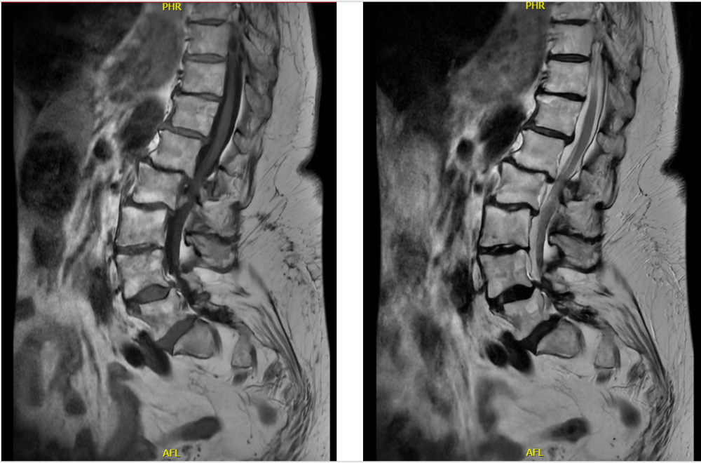 Radiology case #4_5